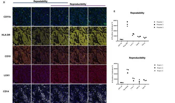 The-complexity-of-myeloid-derived-suppressor-cells-in-non-small-cell-lung-cancer-A-combinatorial-multiplex-IHC-and-flow-cytometry-approach