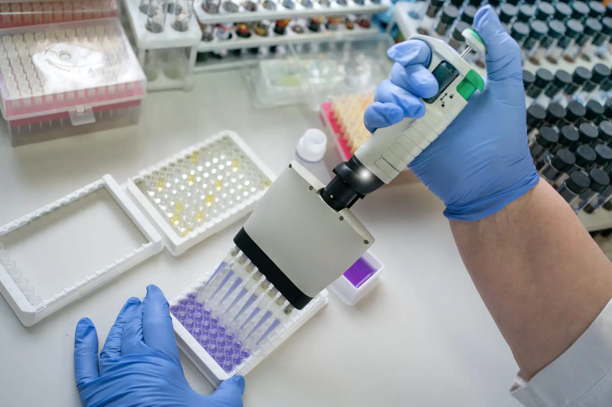 The,Doctor,Makes,An,Enzyme,Immunoassay,For,Syphilis